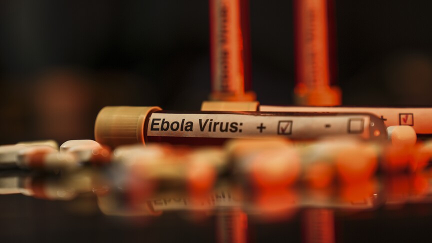 ABD'de 2026 FIFA Dünya Kupası öncesi bazı havalimanlarında Ebola tarama merkezleri kurulacak